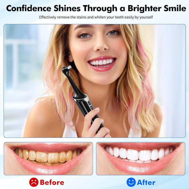 Electric Tooth Polisher,Denture Care, Denture Cleansers, Rechargeable Teeth Cleaning Kit with 6 Cleaning Heads, 5 Speed Modes, LED Ligght, USB-C Charger, IPX6 Waterproof, Easy to Use, for Daily Teeth Cleaning at Home